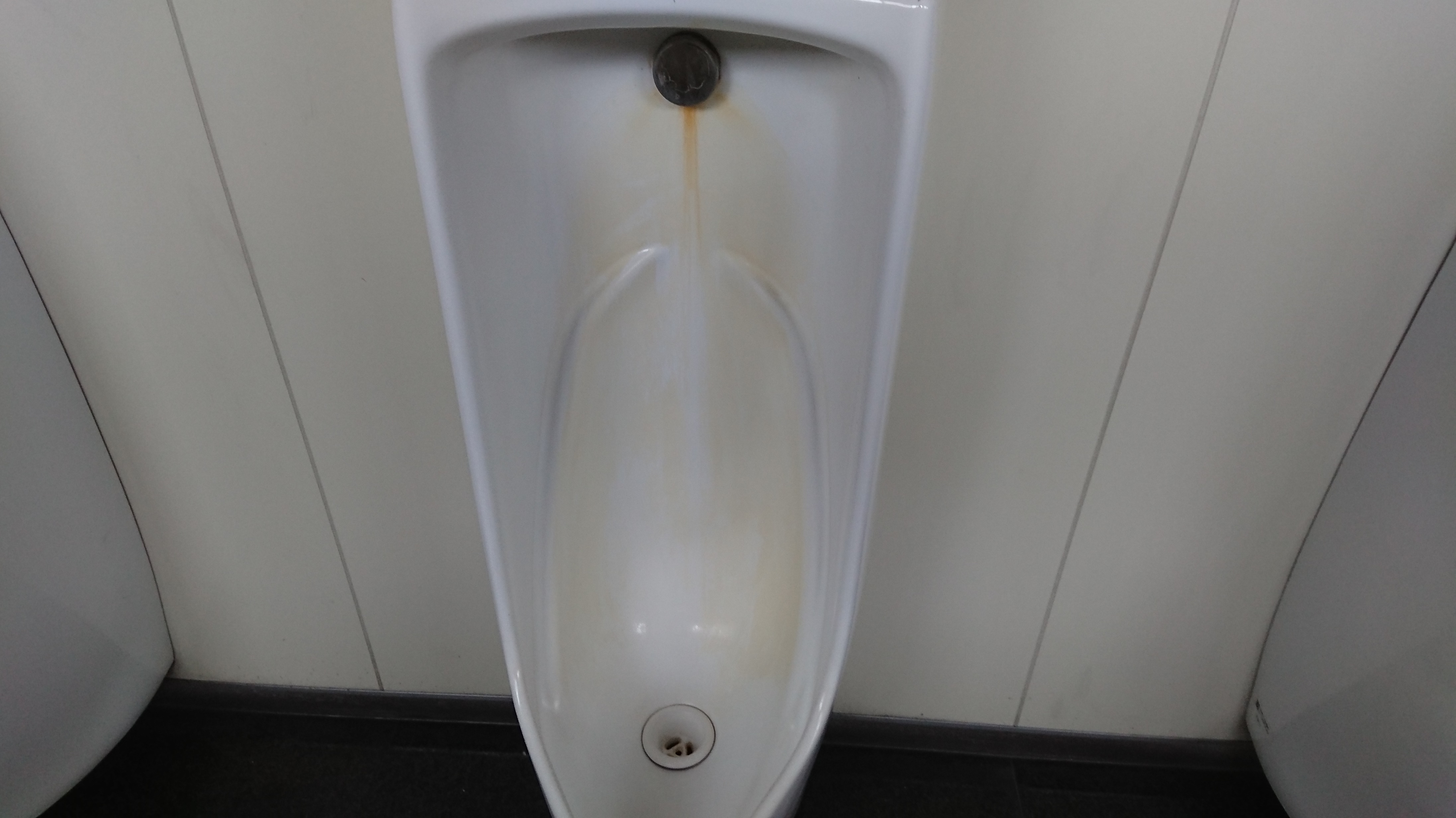 トイレの便器　特殊洗剤洗浄作業